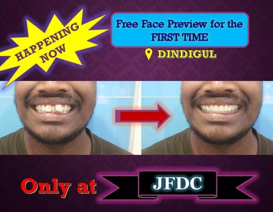 Ceramic Braces