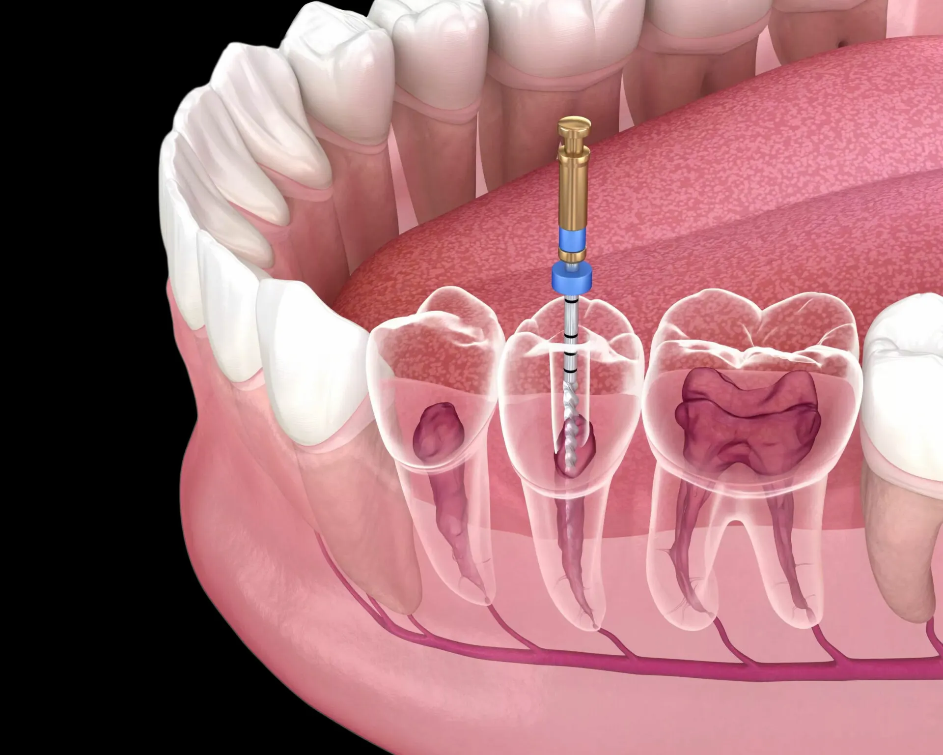 Happy patient saving her natural tooth